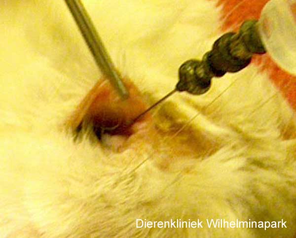 de traanbuis wordt onder verdoving doorgespoeld